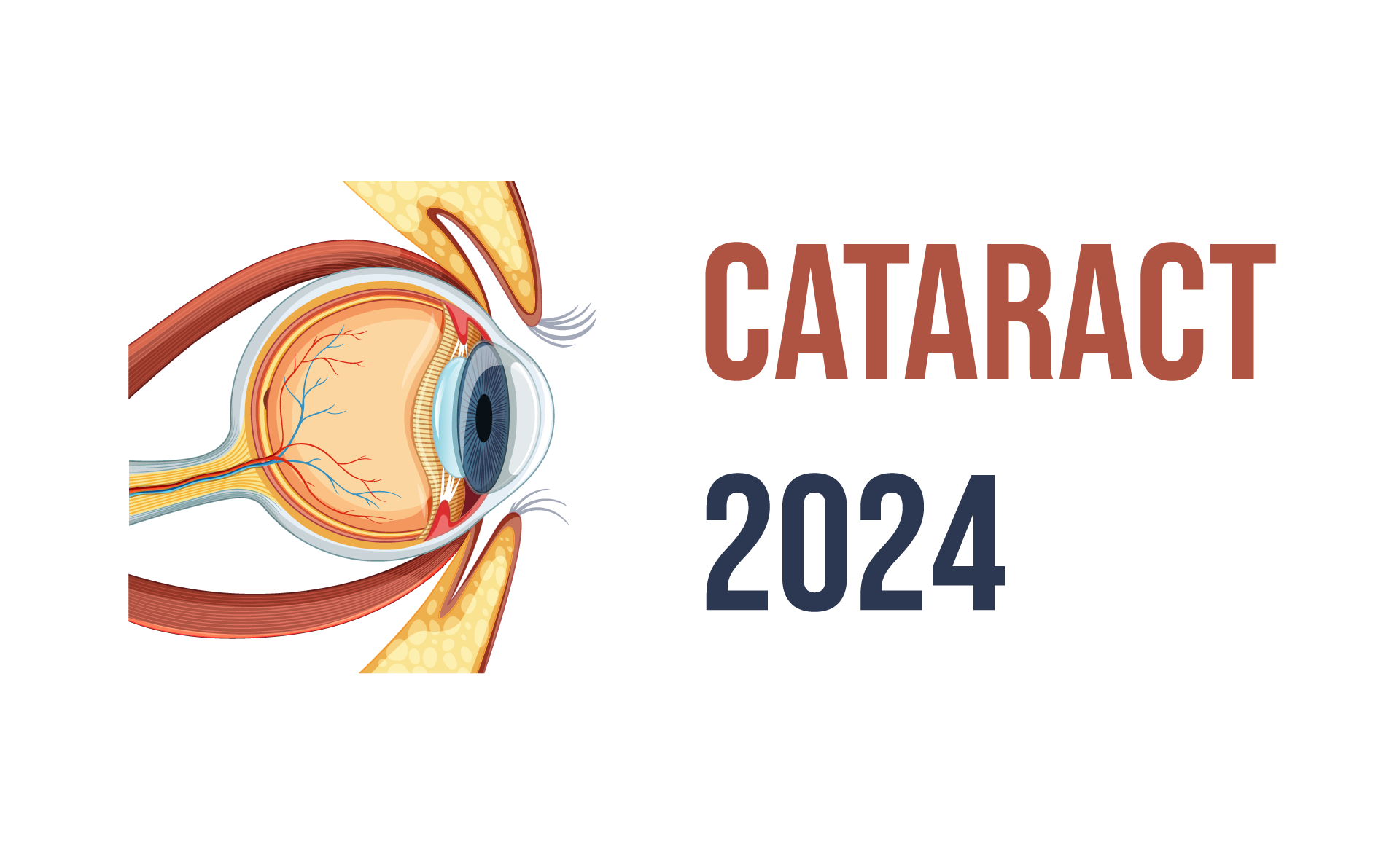 International Conference on Cataract and Refractive Surgery